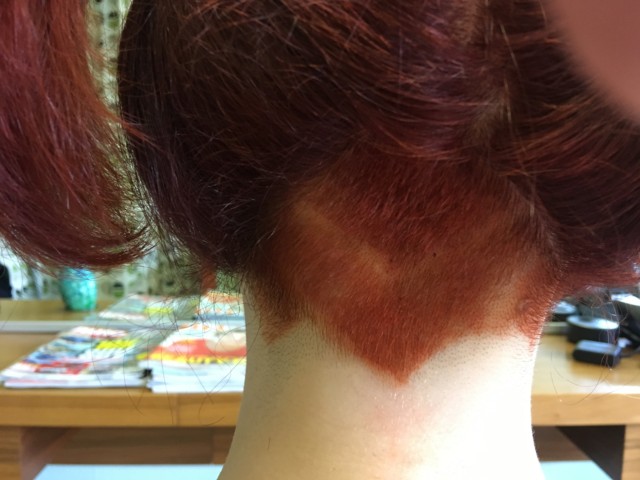 Undercut